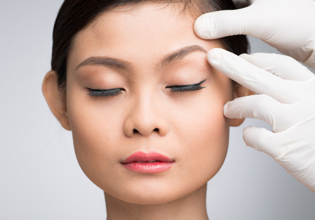 asian blepharoplasty1